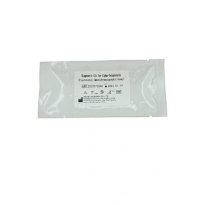 Diagnostic test Kit for Alpha-fetoprotein Fluorescence Immunochromatographic Assay with factory price and stable quality