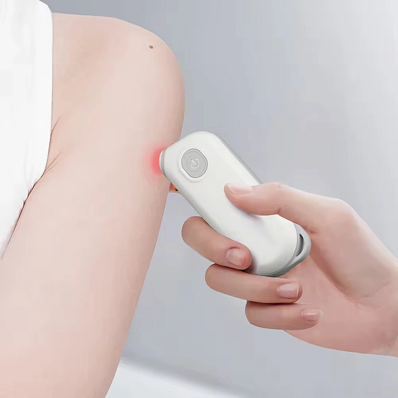 Battery Electric Mosquito Insect Bug Bite Remover Reliever  After Bite Stitch Healer Relief Heating Pen