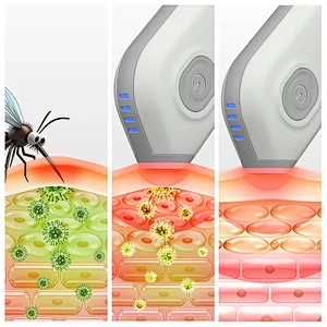 Battery Electric Mosquito Insect Bug Bite Remover Reliever  After Bite Stitch Healer Relief Heating Pen