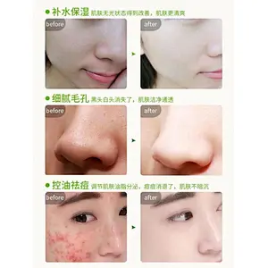 Cheap Promotional Cosmetic Beauty Oily Skin Green Bean Facial Mud Mask