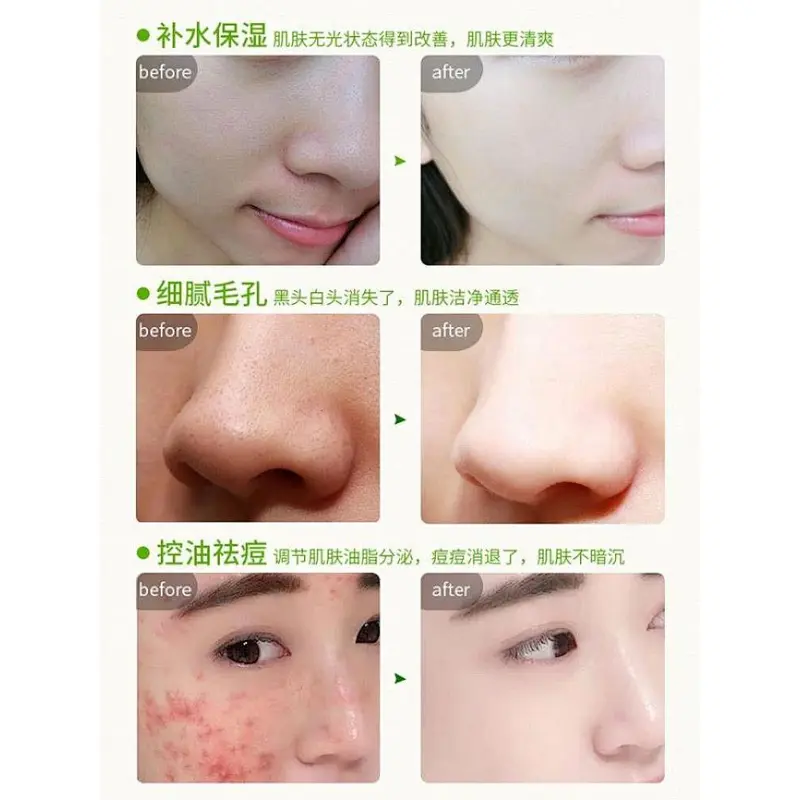 Cheap Promotional Cosmetic Beauty Oily Skin Green Bean Facial Mud Mask