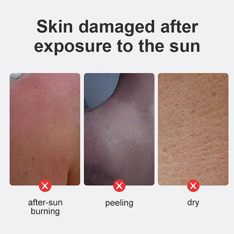 OEM ODM Custom Private Label Sun Damaged Skin Repair Moisturizing Cream After Sun Cooling Best Soothing Gel