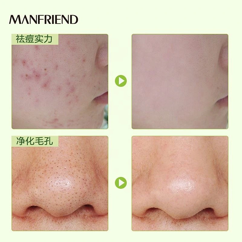 Mask Cosmetic Distributor Face mask Hydrating Repair Lightening Beauty Green Bean Mud Mask