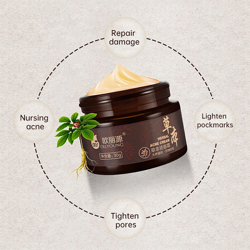 private label acne remove face cream oil control remove pimples acne anti acne cream