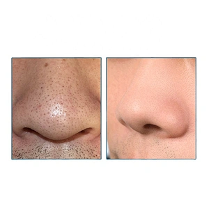 Private Label Pore Deep Cleansing Peel Off Blackhead Strips for Removal nose care Blackhead Remover Sticker Mask