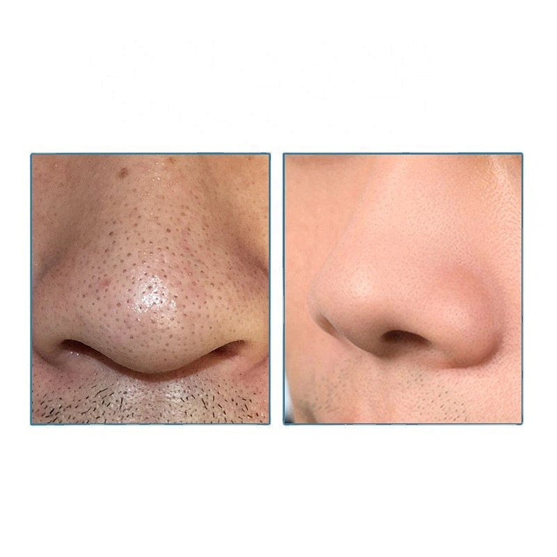 Private Label Pore Deep Cleansing Peel Off Blackhead Strips for Removal nose care Blackhead Remover Sticker Mask