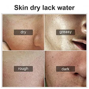 Best Man Skin Firming Moisturizing Lighten Facial Oil-control Balancing Skin Face Toner For Men