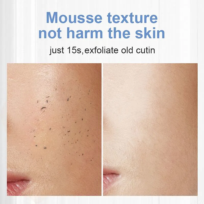 Newest Style Skincare Dead Skin Peeling Remover Skin Whitening SoftenBody Scrub Facial Exfoliating Mousse