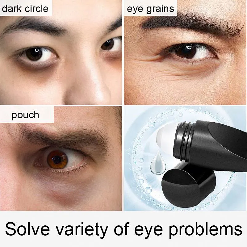 Wholesale Roller Ball Remove Dark Circles Hyaluronic Firm Anti Wrinkle Puffy Eye Bag Removal Cream