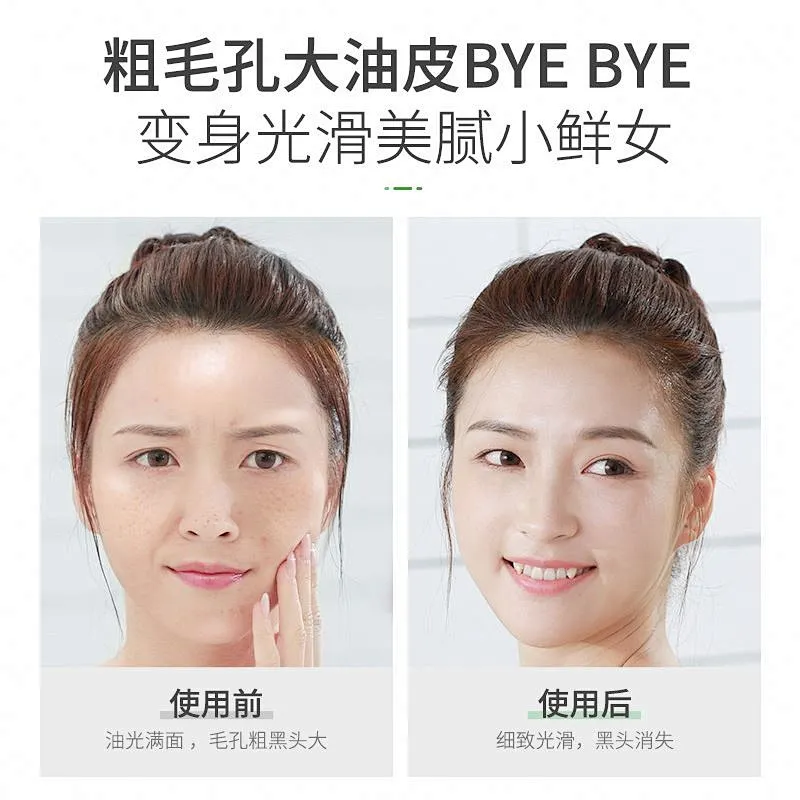 Wholesale Oem Private Label Custom Anti Acne Oil Control Pure Tea Tree Essential Oil