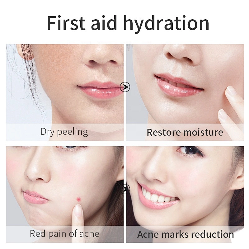 Factory Price Private Label Skin Care Forever Natural Skin Soothing moisturizing cream Aloe Vera Gel For Skin Lightening