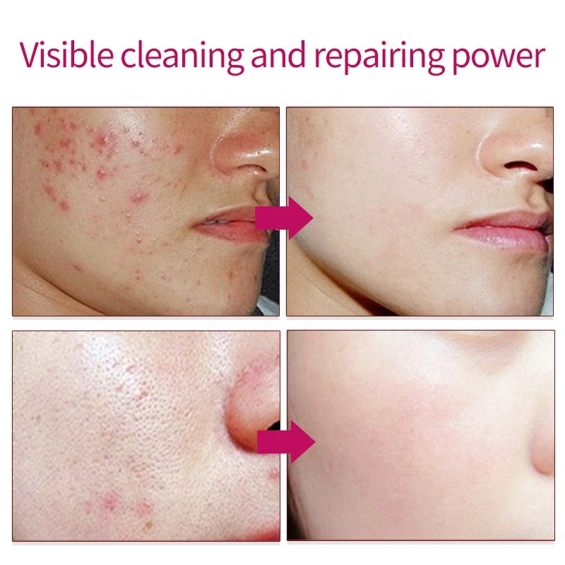 OEM ODM Facial Wax for face Exfoliating Blackhead Remover Pore Firming Anti-aging Facial Wax Peel Off Face Wax Mask