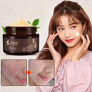 Private label herbal 30g ance hydration cream scar remove now whitening night glow cream for ance