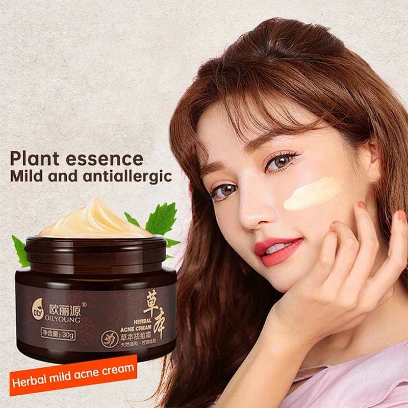 private label acne remove face cream oil control remove pimples acne anti acne cream