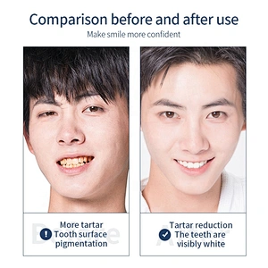 private label natural white pearl activated charcoal teeth whitening powder
