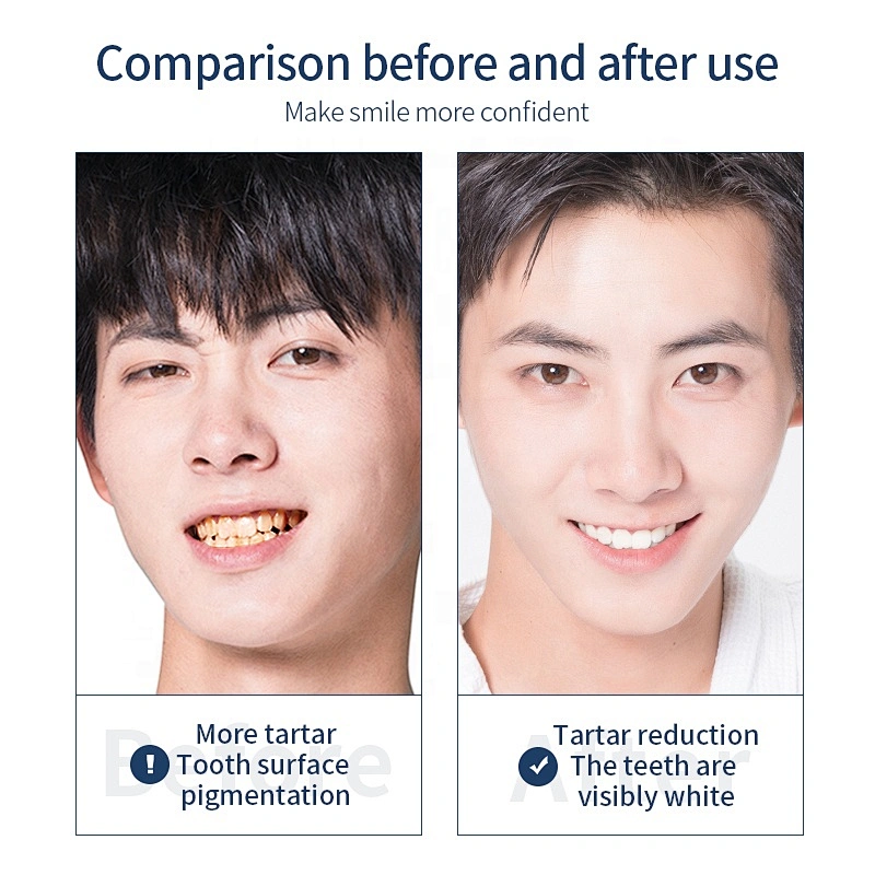 private label natural white pearl activated charcoal teeth whitening powder