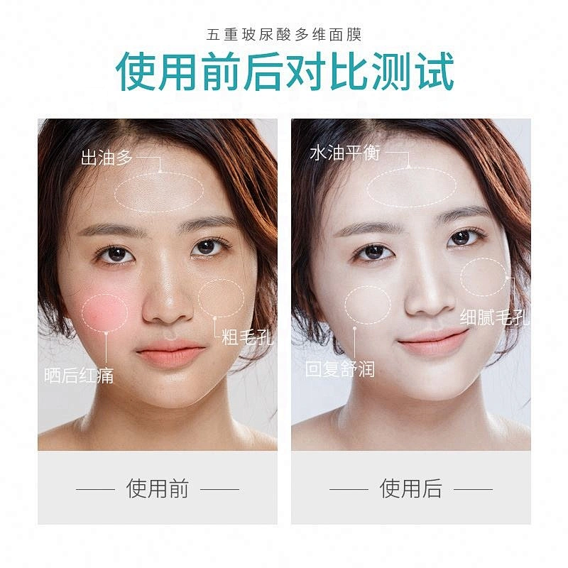 Fashion Design Ladies Hyaluronic Acid Hydrating Private Label Face Moisturizing Mask