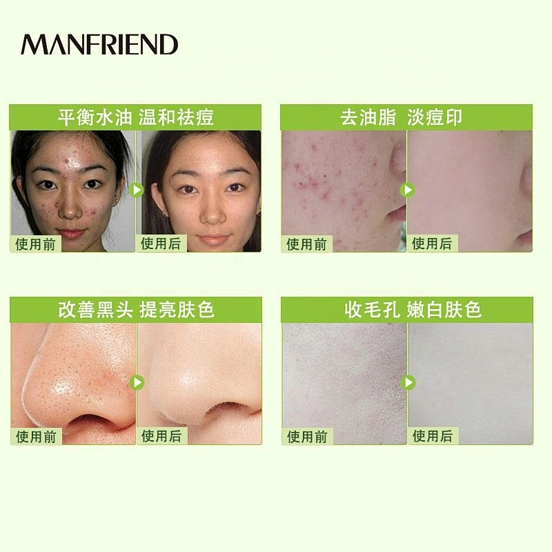 Mask Cosmetic Distributor Face mask Hydrating Repair Lightening Beauty Green Bean Mud Mask