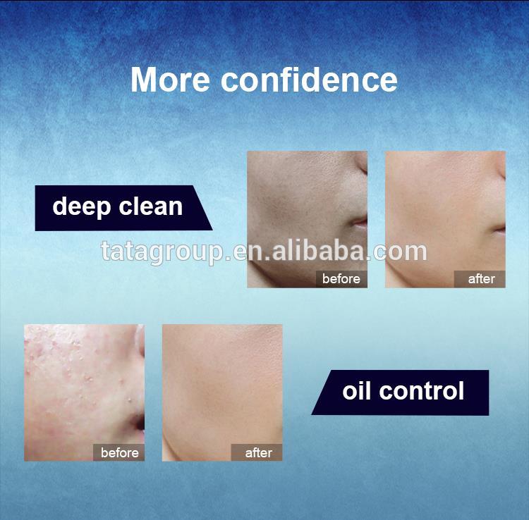High Quality Best Customized Private Label Wholesale Oil Control Face Wash Foam Facial Cleanser For Men