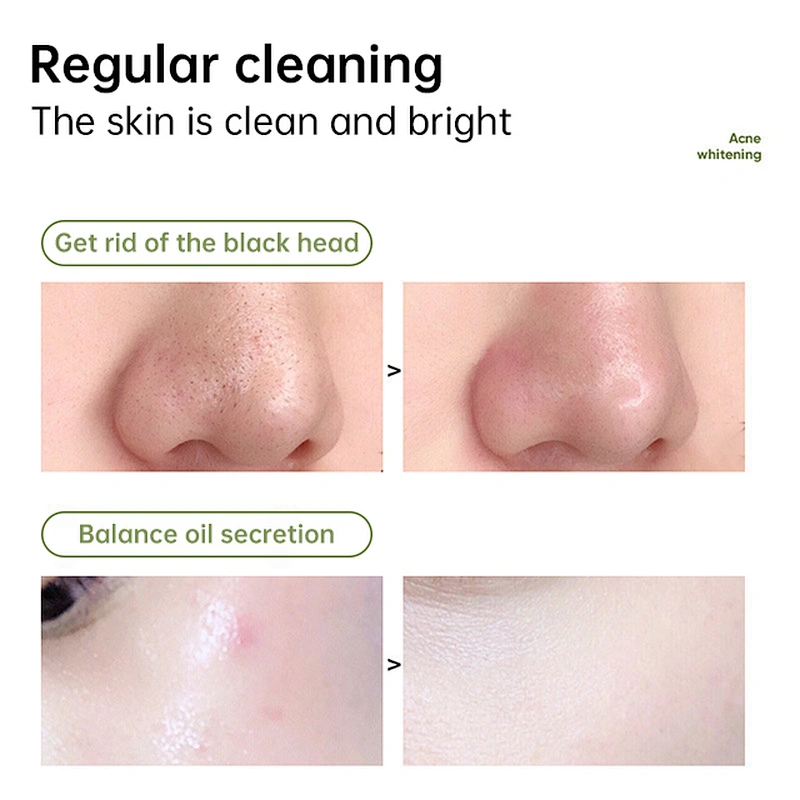 Custom Private Label Facial Deep Cleansing Anti Acne Whitening Multiple-effect Vegan Organic Green Mud Face Clay Mask