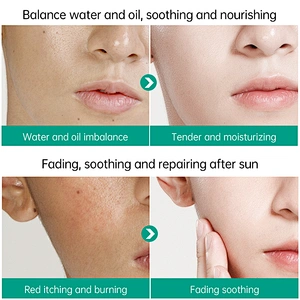 Private Label Natural Oem Anti Acne Moisturizing Repairing Soothing Aloe Vera Gel For Face