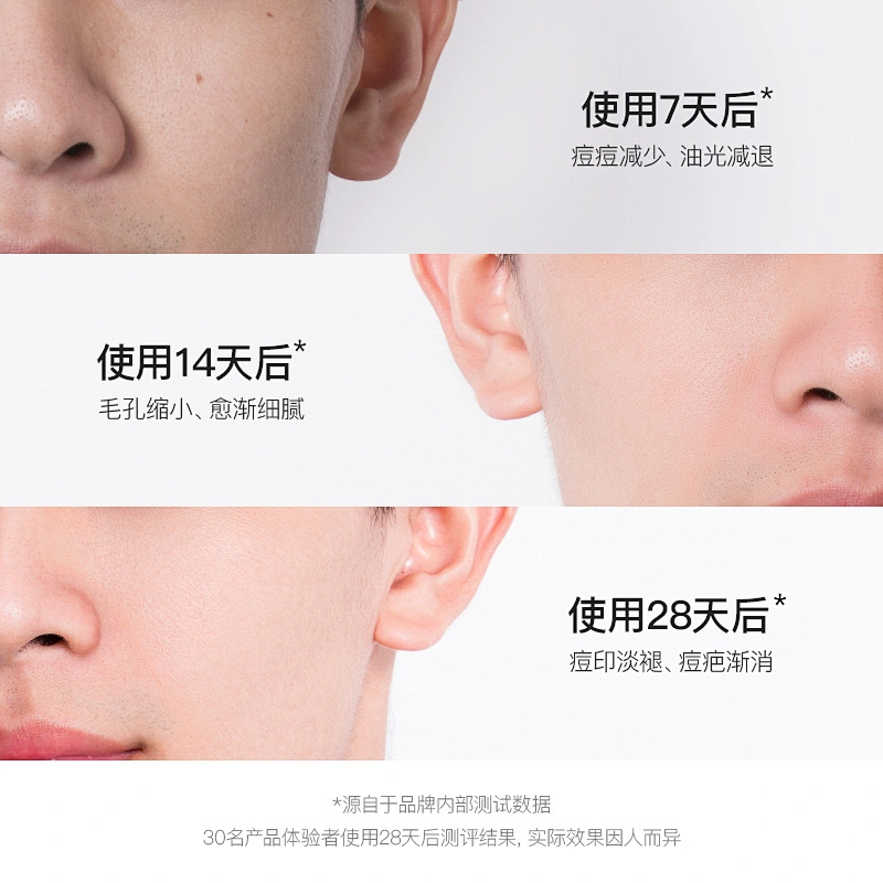 OEM ODM Private Label Natural Skin Care Pore Ordinary  Men Face Serum