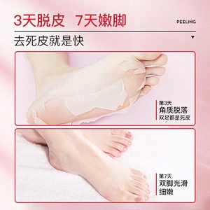 Best Private Label Feet Exfoliating Peeling Foot Peel Mask