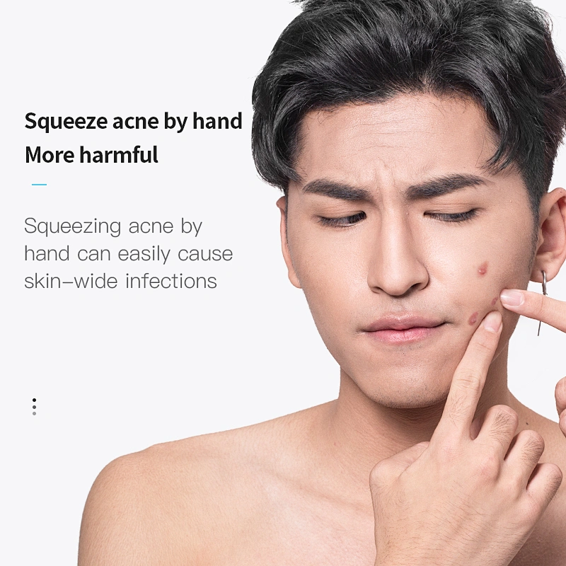OEM ODM Men Shrink Pores Firming Essence Acne Treatment Scar Removal  Anti Acne Serum