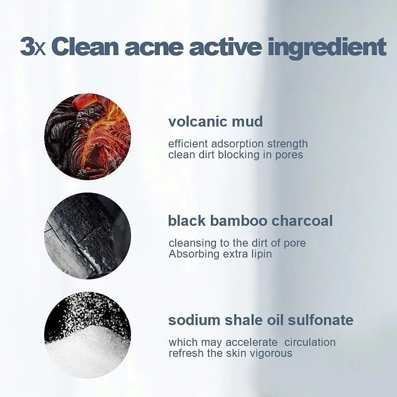 Custom Logo Soap Stamp Anti Acne Moisturizing Facial Body Lighting Soap