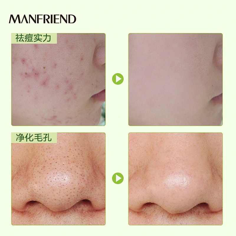 Wholesale Hot Skin Care Natural OEM Mung Bean Green Private Label Face Mud Mask