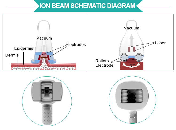 body shaping velashape machine price