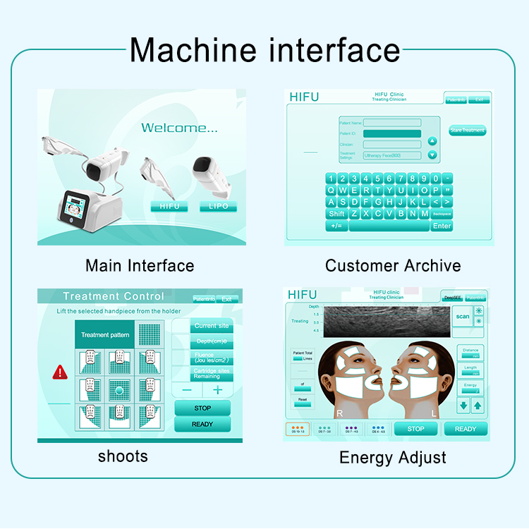 machine for home use/mini hifu for face lifting