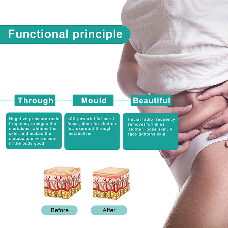 Korean RF vacuum cavitation machine for body shape and face lifting and lymphatic drainage