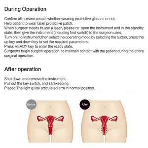 Hot sale Portable Fractional CO2 laser machine co2 laser cutting machine for vagina treatment