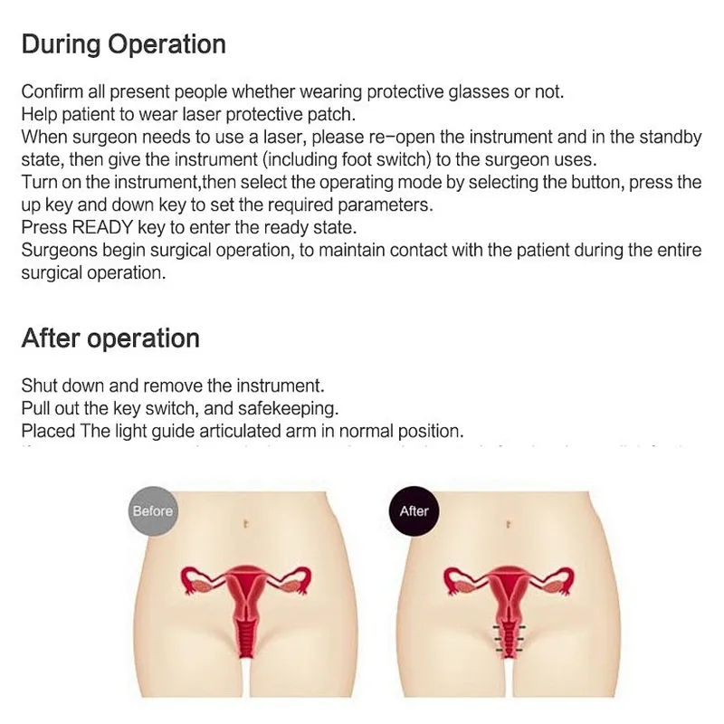 Hot sale Portable Fractional CO2 laser machine co2 laser cutting machine for vagina treatment
