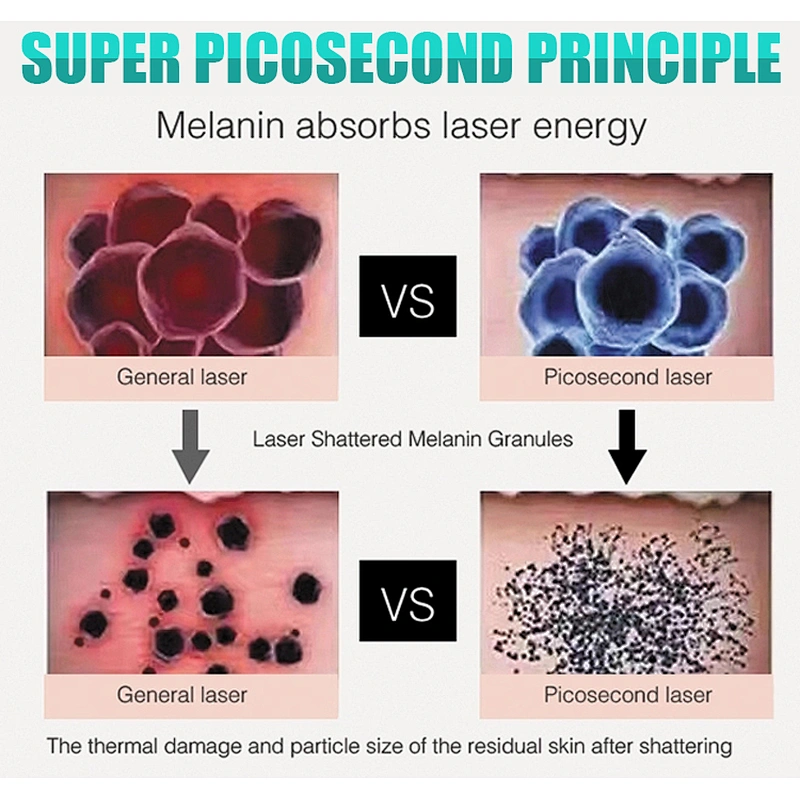 C 1064nm 532nm 755nm picosecond laser machine for tattoo removal