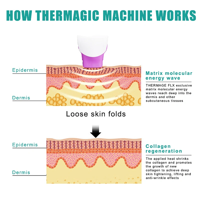 9D HIFU thermagic machine