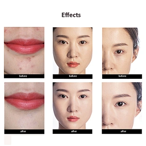 Wholesale Private Label 6 Color Concealer Palette Makeup Contour Palette Face Concealer