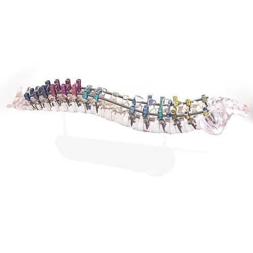 Tech Titanium Material Spinal Screw Spinal Instrument