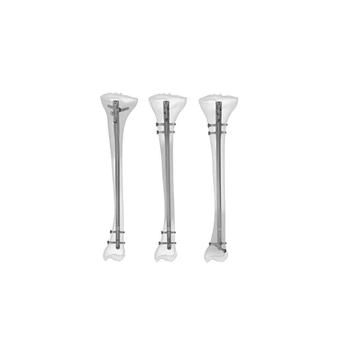 Interlocking intramedullary nail