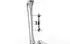 Horizontal Limb Reconstruction External Fixation System