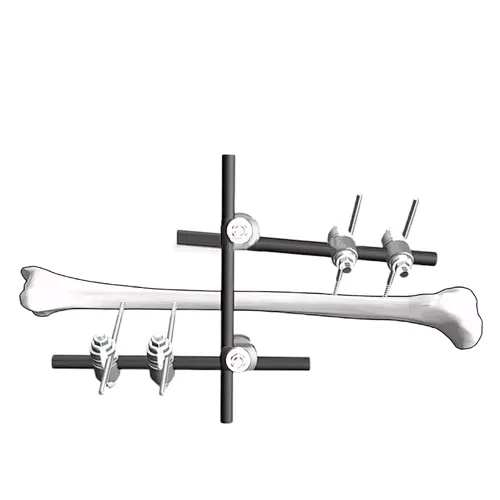 Φ11 Dissection IVTibia External Fixation