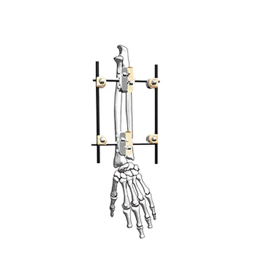 Dissection IV(Φ5)Radius External Fixation