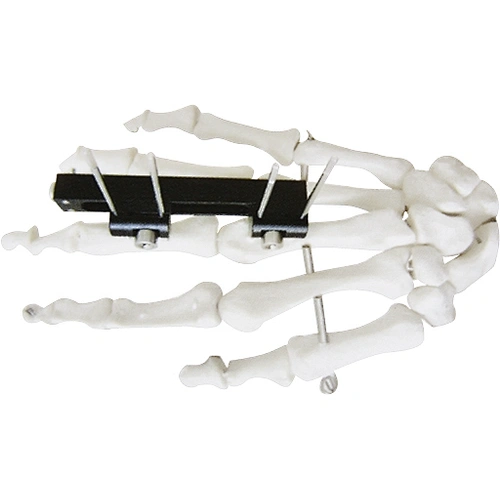 Joint Fixator Rail Finger External Fixation