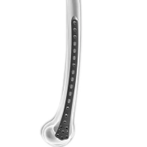 Distal Femoral Condyle Locking Plate