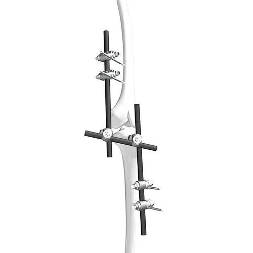 Dissection IV(Φ11)Knee Joint Bridge External Fixation