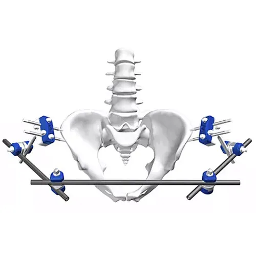 Pelvic Frame External Fixation