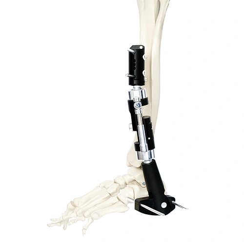 External Fixation