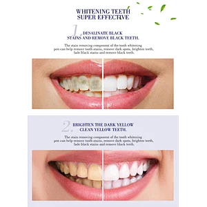 Fast Whitening Result Carbamide Peroxide Gel Teeth Whitening Gel Pen teeth whitening kit Teeth Whitening Pen Teeth Whitening Gel