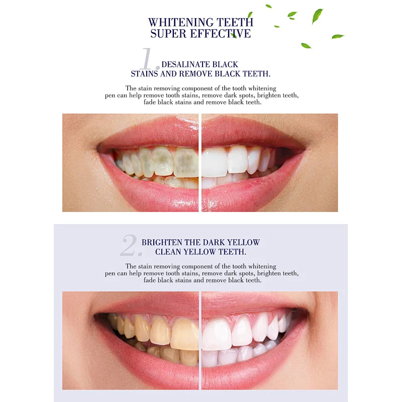 Fast Whitening Result Carbamide Peroxide Gel Teeth Whitening Gel Pen teeth whitening kit Teeth Whitening Pen Teeth Whitening Gel